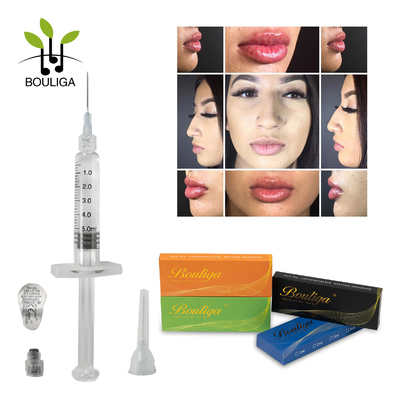Koopt de Huidvuller Injecteerbaar Ha van de gezichtszorg Online Hyaluronic Zuur voor Lippen