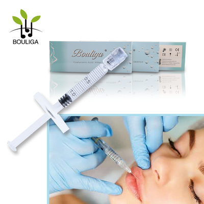 Bouliga Cross-Linked Hyaluronic Zure Injecteerbare Vuller1ml Derm Lijn voor lippen