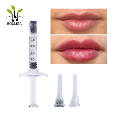 Ha-injecties, hyaluronic zure huidvuller voor lippenenchance