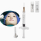 Koreaanse Lippen1ml Hyaluronic Zure Huidvuller voor Marionetlijnen